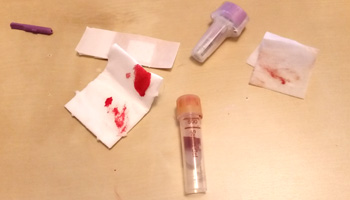 Blood sample for IgG test