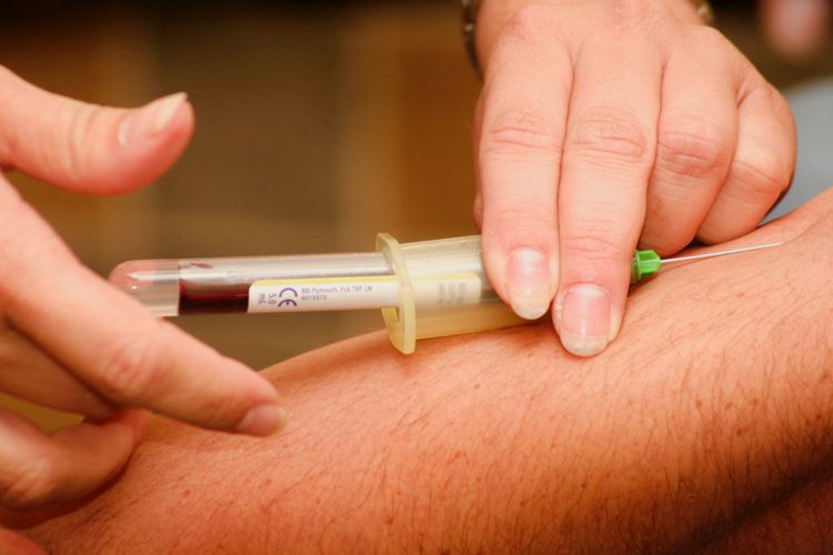 Wie Funktioniert Die Diagnose Der Laktoseintoleranz Nmi Portal
